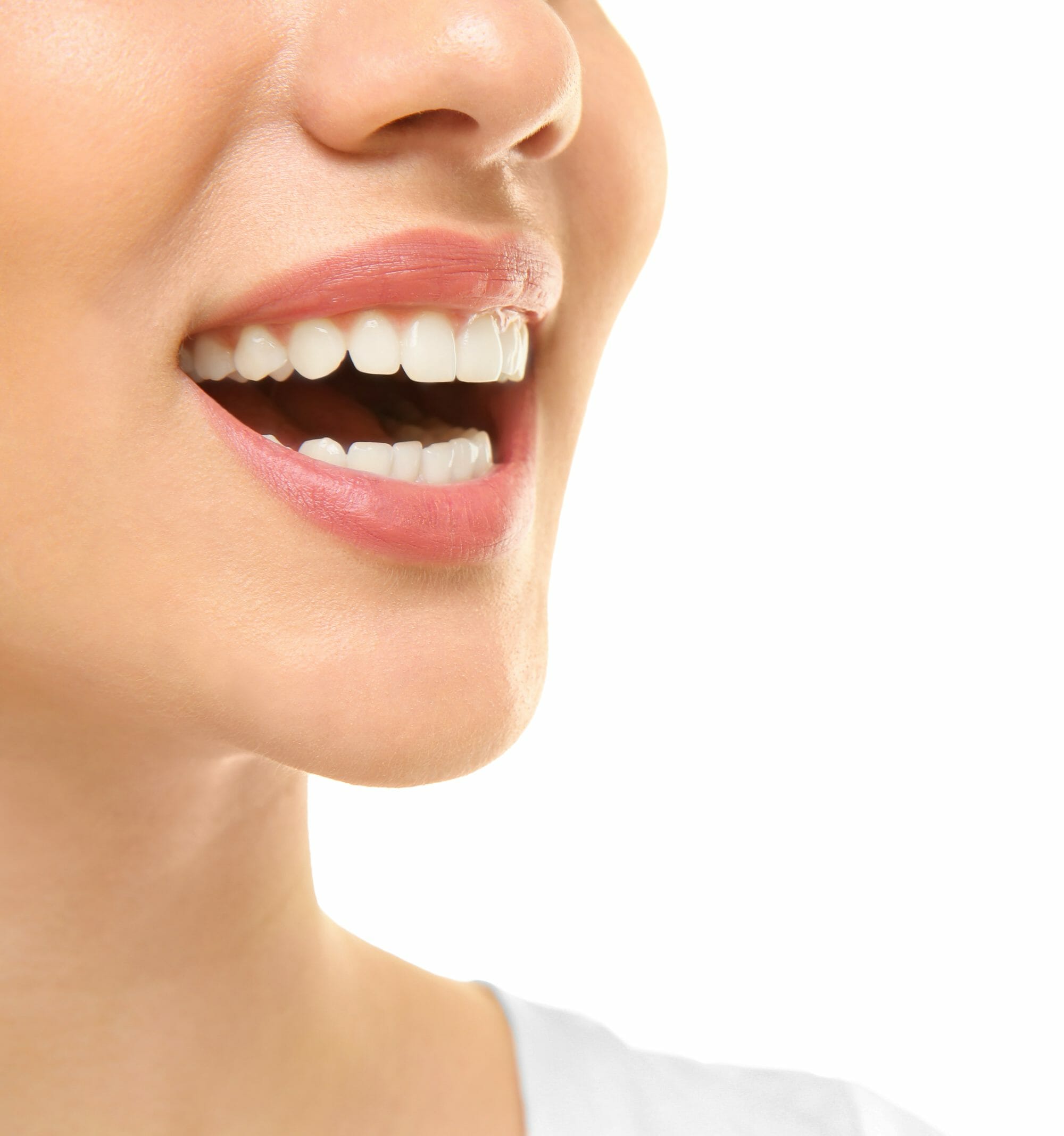 5 Benefits of Dental Bonding Dentistry of West Bend